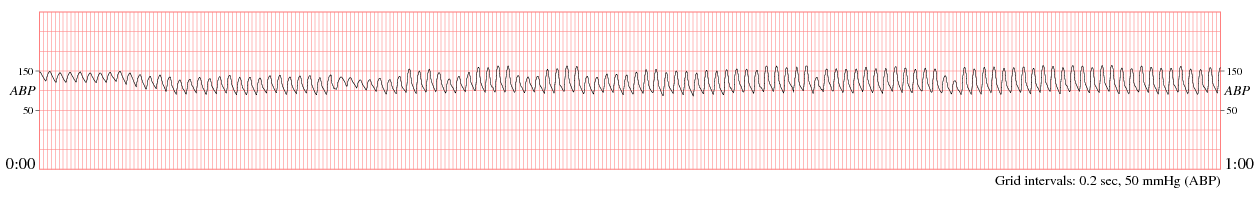 sample waveform