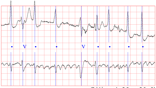 [ sample ecg ]