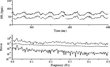 HR time series and spectra during periodic obstructive apneas