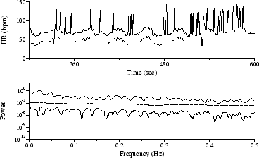 HR time series from Figure 3, corrupted by added noise, with
corresponding spectra