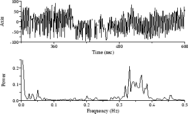 Electrical axis time series (above), with Lomb spectrum (below)