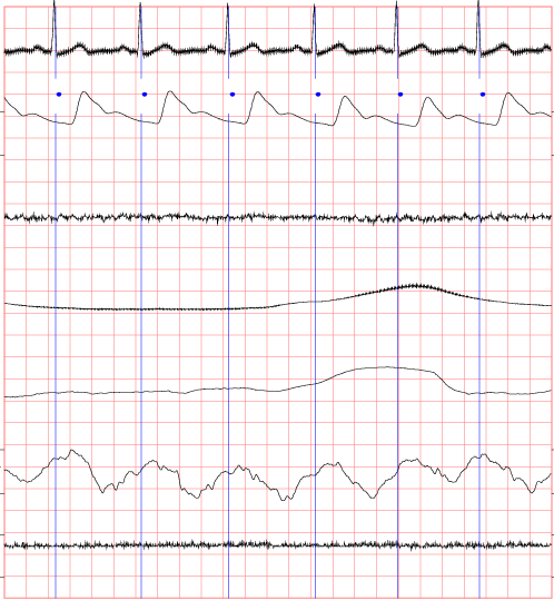 sample waveforms