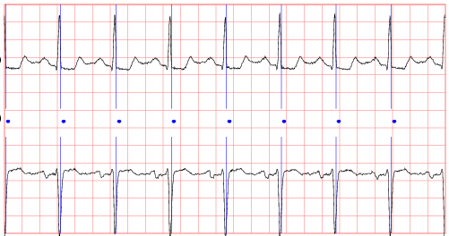 sample waveforms