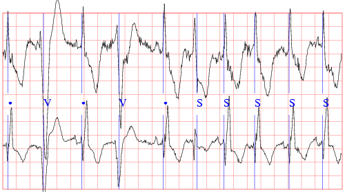 sample waveforms