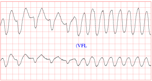 sample waveforms