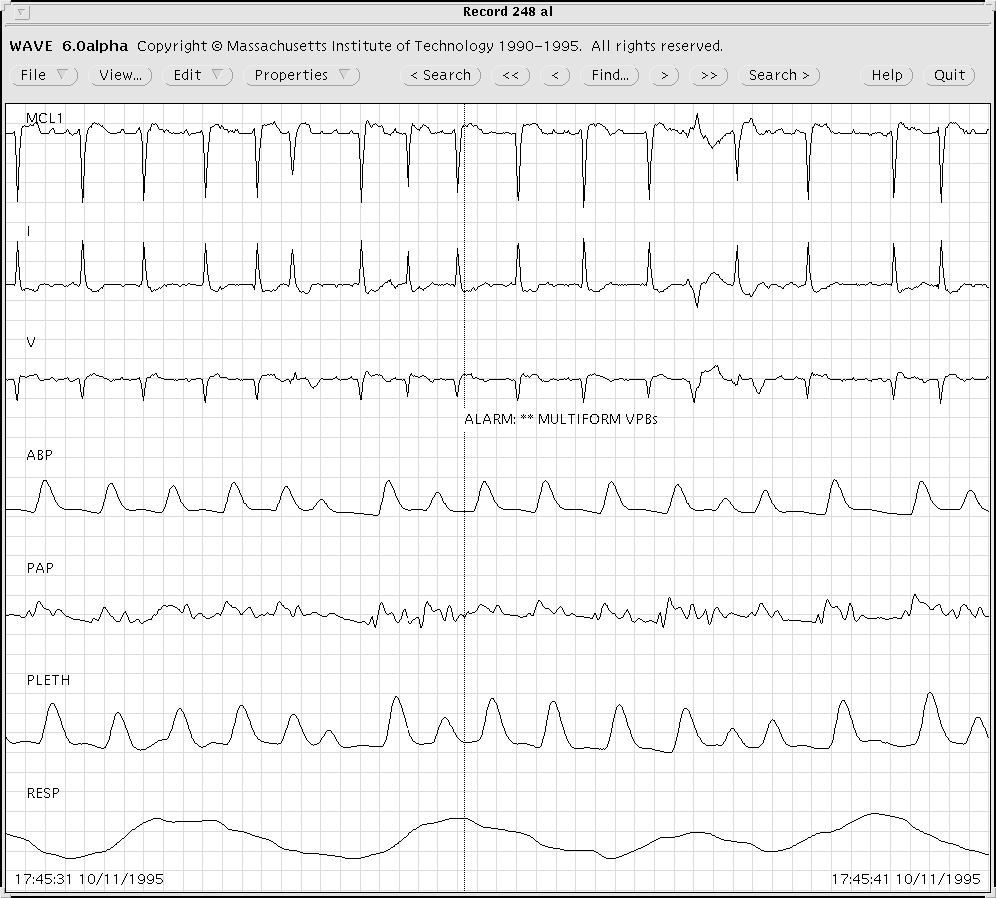 figure17