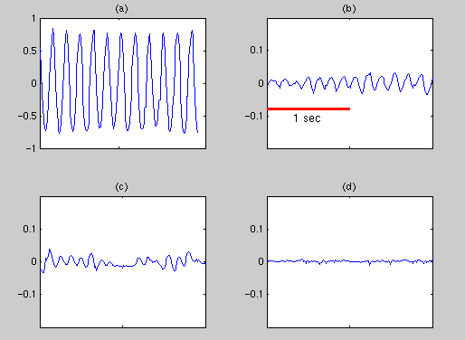 Parkinsonian rest tremor velocity recording (subject g2) under four conditions