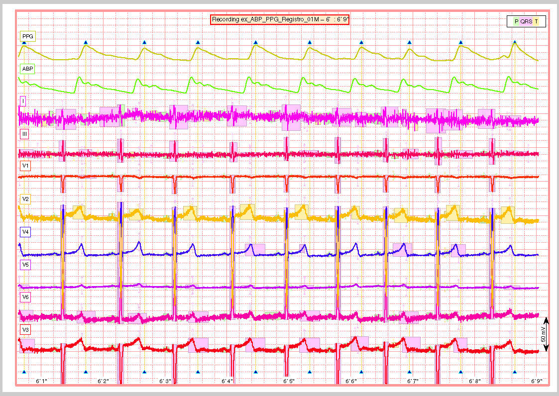 _images/ex_ABP_PPG_Registro_01M_full_Pagina_05.png