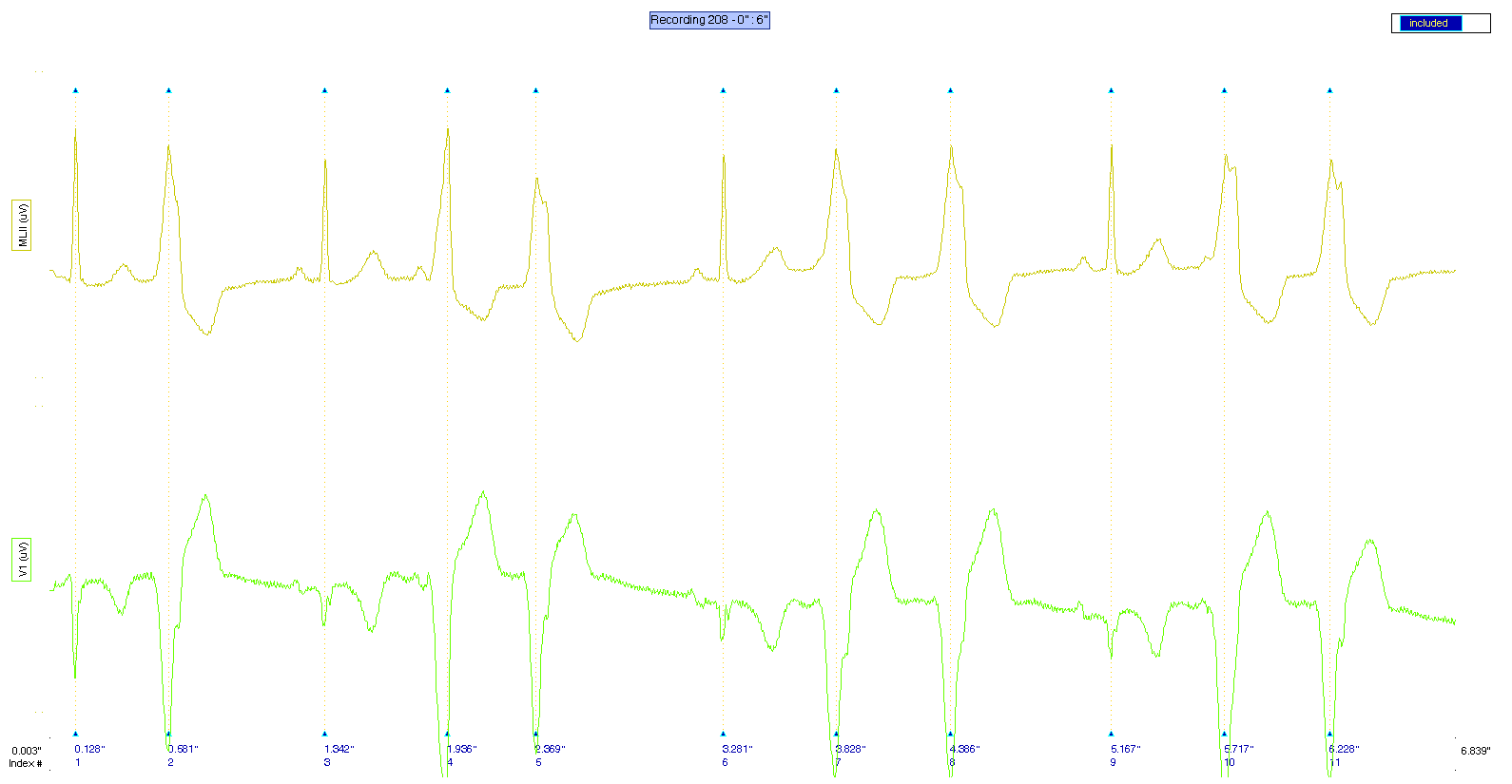 _images/plot_ecg_strip.png