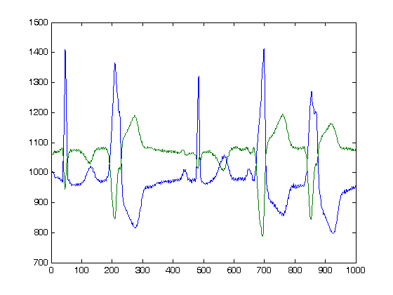 _images/read_signal_example.png