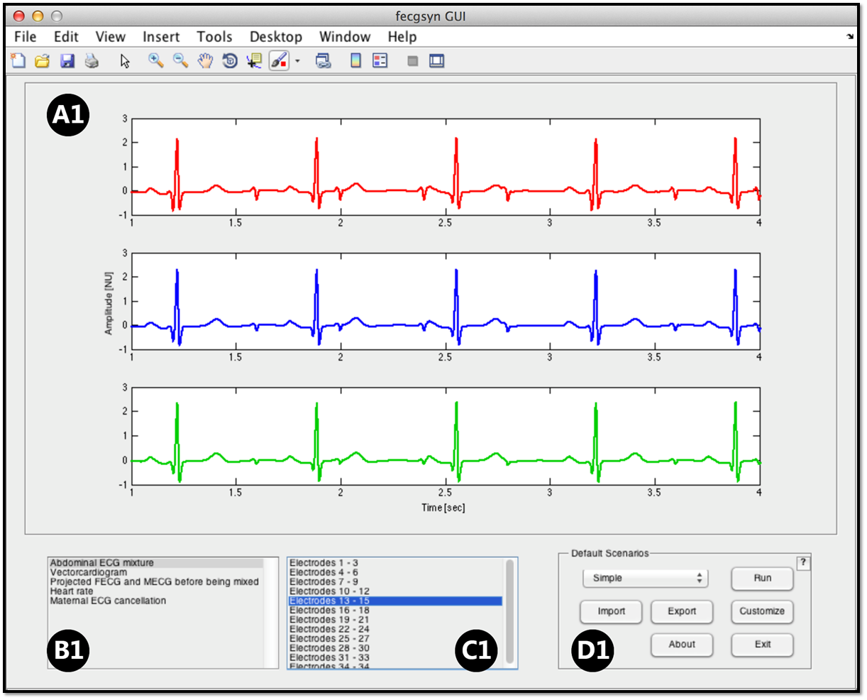 ECGSYN: A realistic ECG waveform generator