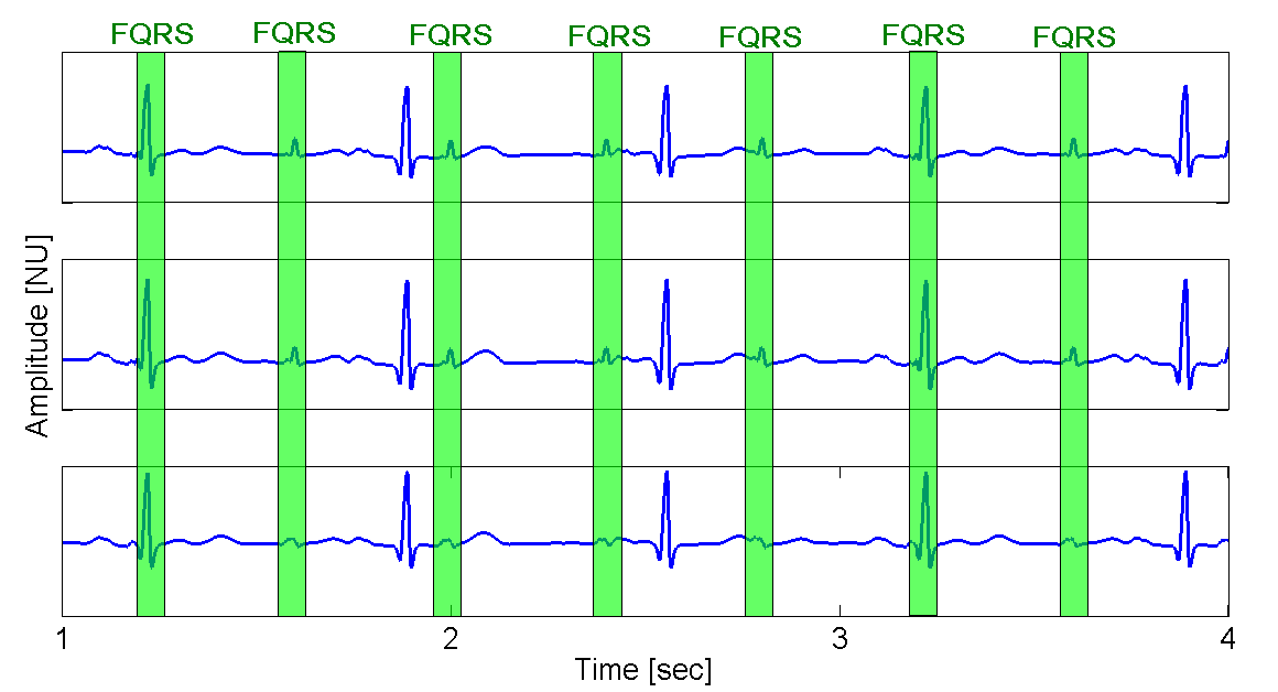 [simple case eeg]