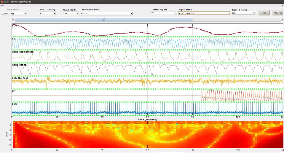 WFDB Toolbox for MATLAB and Octave