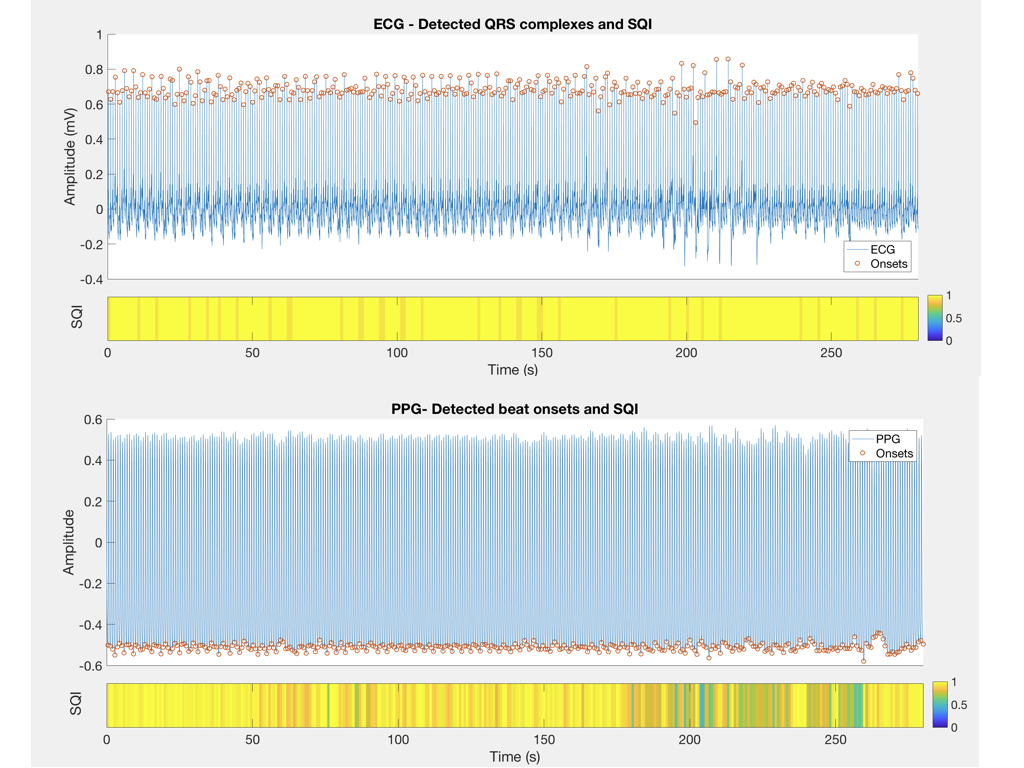 [screenshot of hrv-toolkit-matlab]