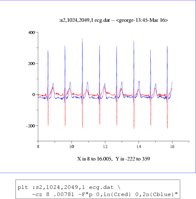 \begin{figure}\begin{center}
\fcolorbox{blue}{white}{
\epsfig{file=ecg,height=10...
...0,1n(Cred) 0,2n(Cblue)''\end{boxedverbatim}
\end{center}\end{center}\end{figure}