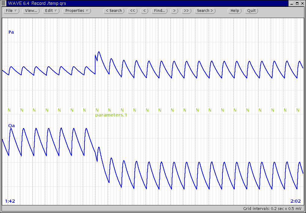 [Sample RCVSIM output]