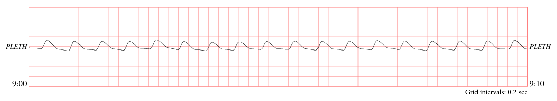 sample waveform