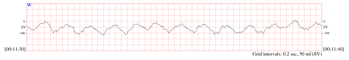 sample waveform