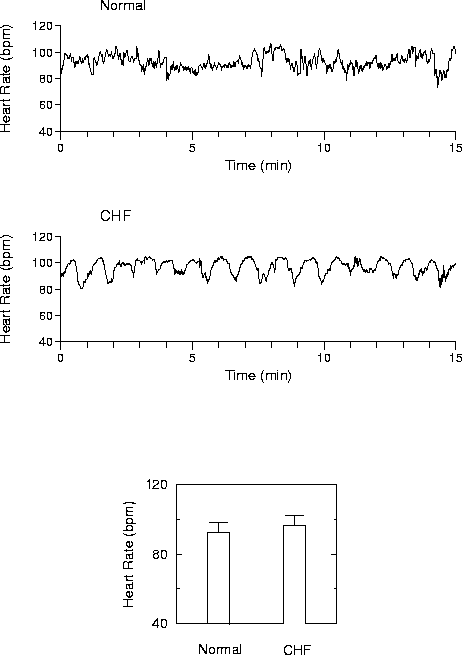 [Plots of two heart rate time series]