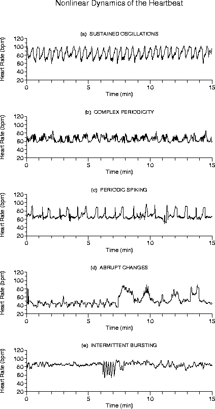 [Plots of five heart rate time
series]